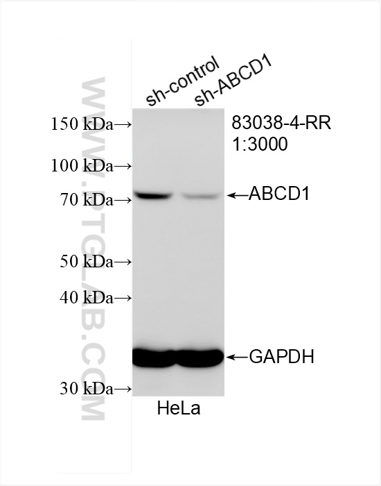 WB analysis of HeLa using 83038-4-RR (same clone as 83038-4-PBS)