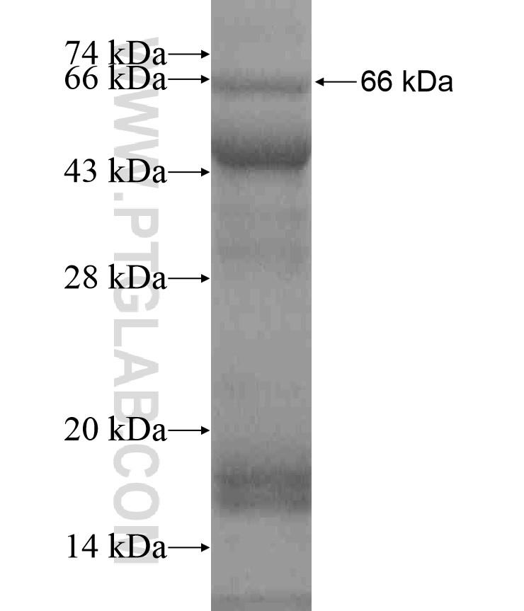 ABCG8 fusion protein Ag18526 SDS-PAGE