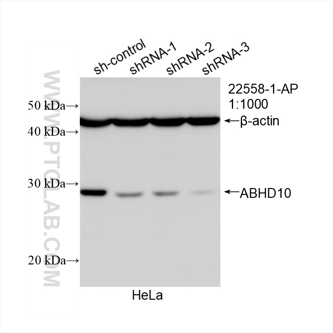 WB analysis of HeLa using 22558-1-AP