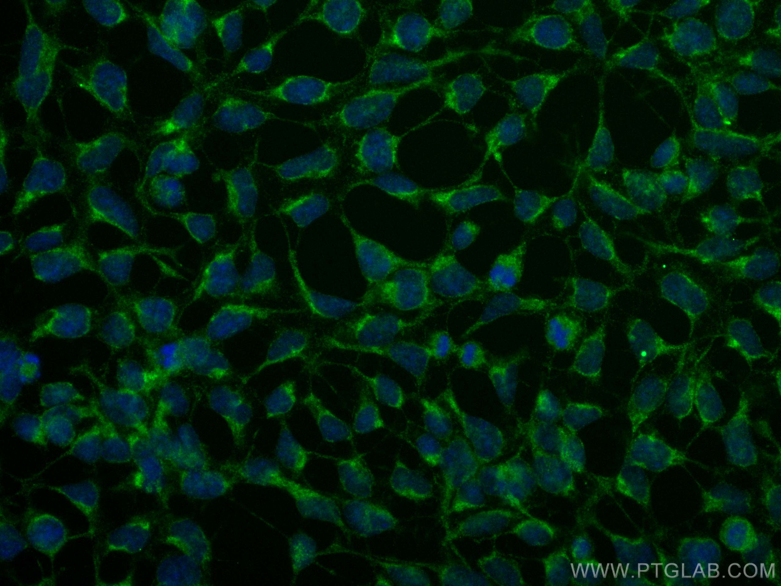 IF Staining of HEK-293 using 14039-1-AP