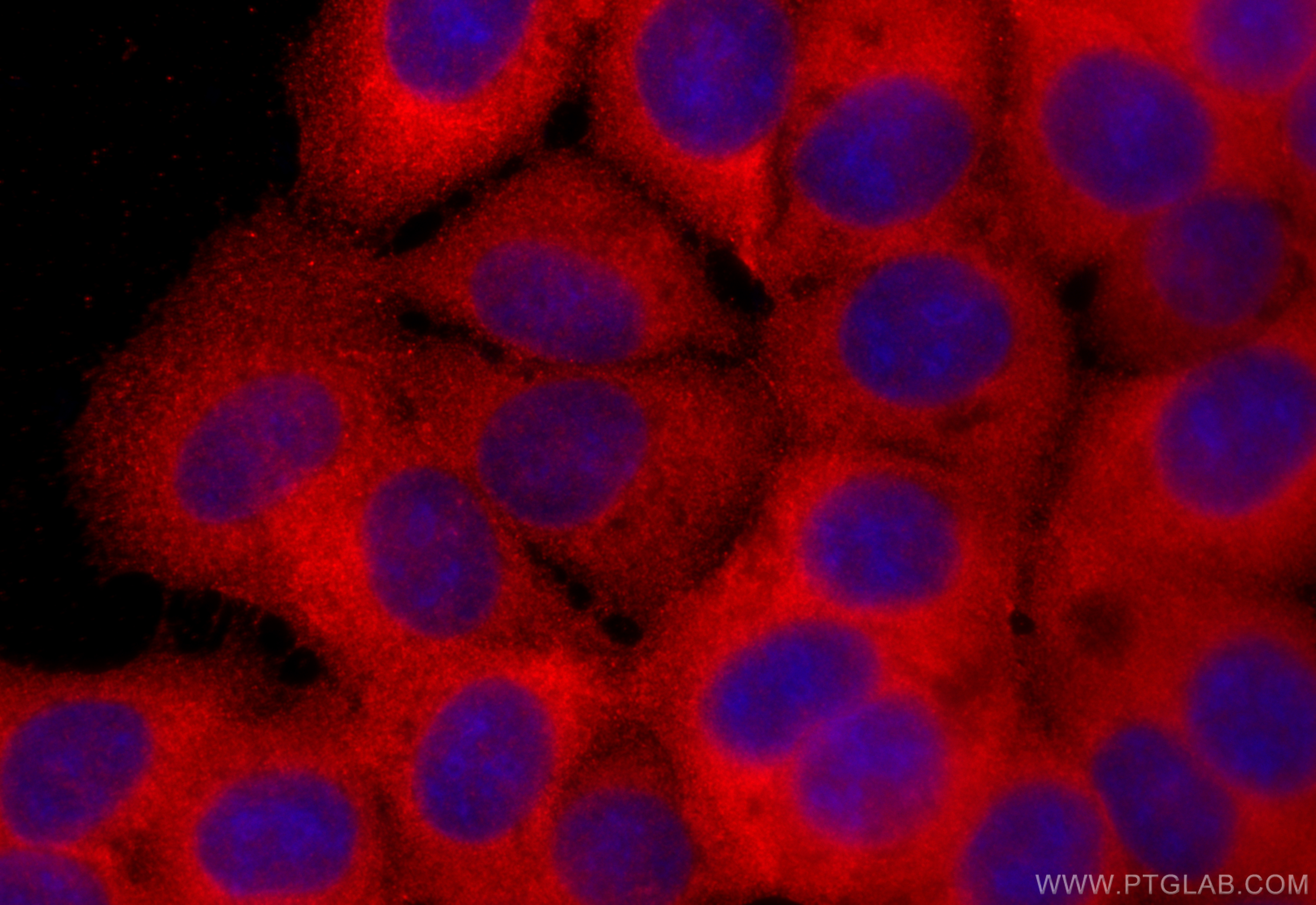 IF Staining of MCF-7 using 12201-1-AP