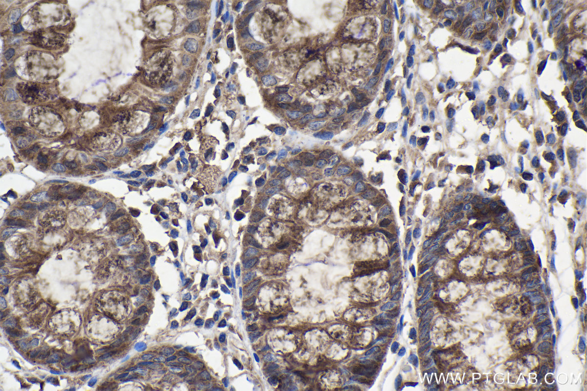 IHC staining of human colon using 12201-1-AP