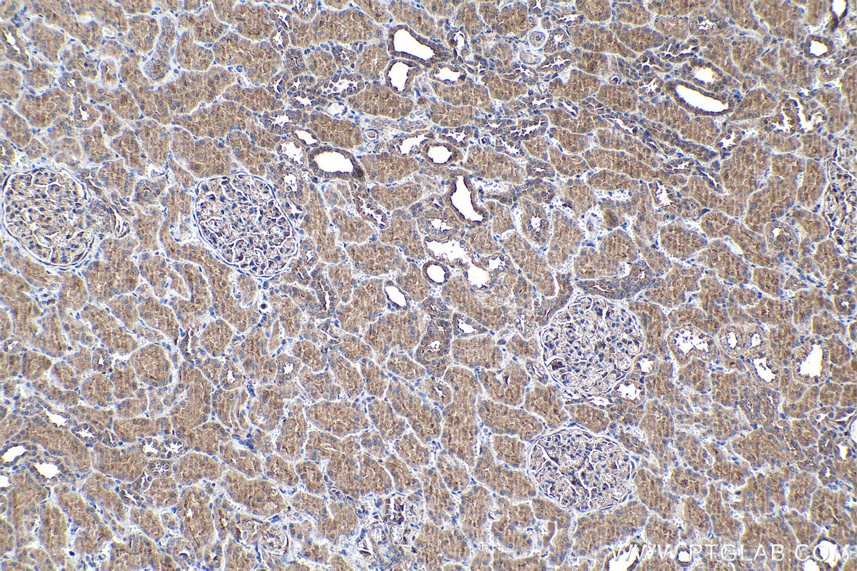 IHC staining of human kidney using 12201-1-AP