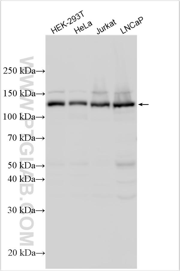 ABL1