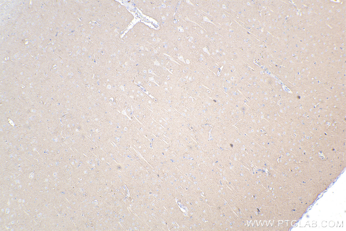 IHC staining of rat brain using 29350-1-AP