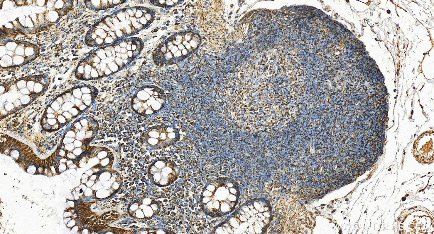 IHC staining of human colon using 11111-1-AP