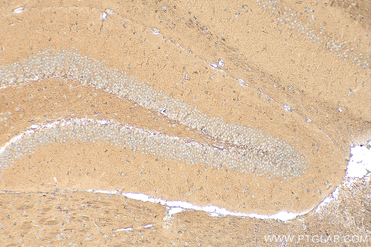 IHC staining of mouse brain using 21923-1-AP