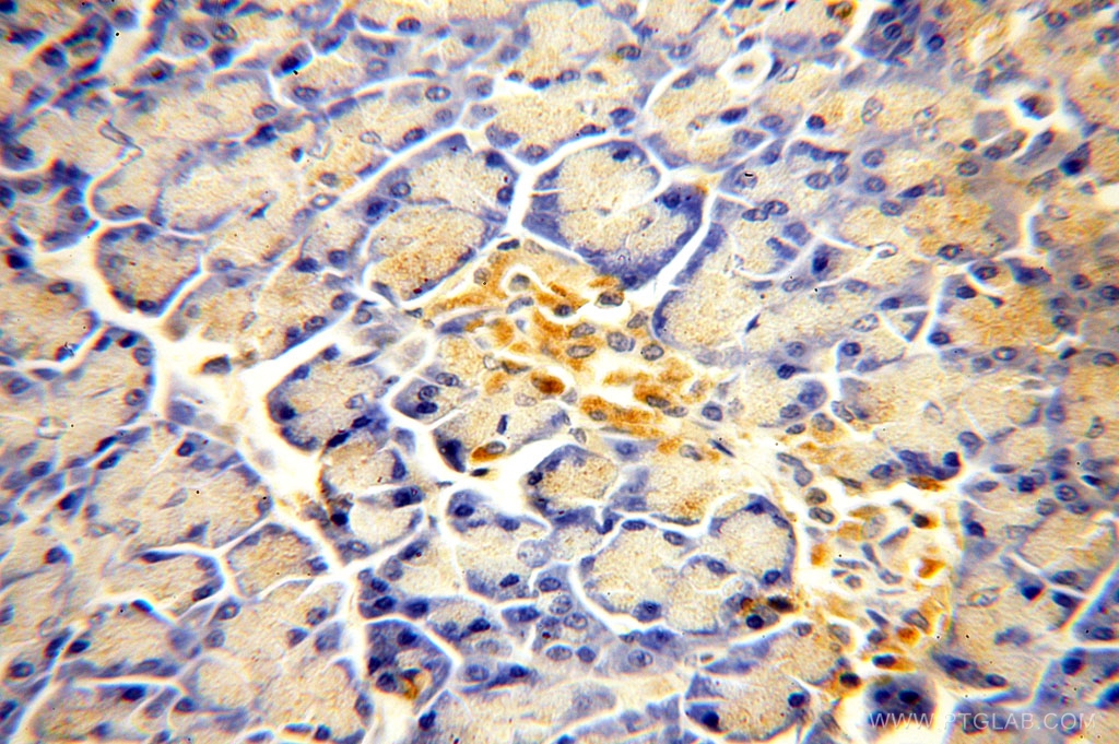 IHC staining of human pancreas using 17161-1-AP