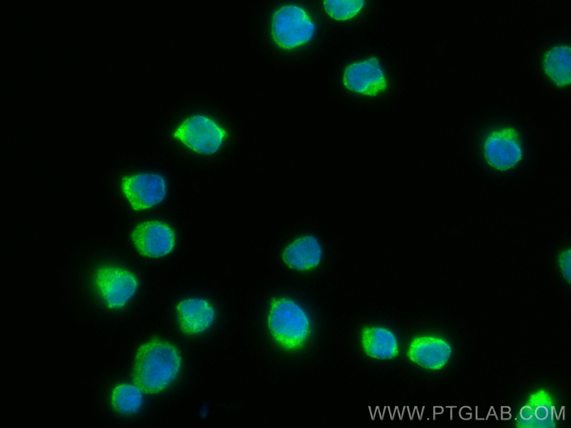 IF Staining of Jurkat using 82967-1-RR