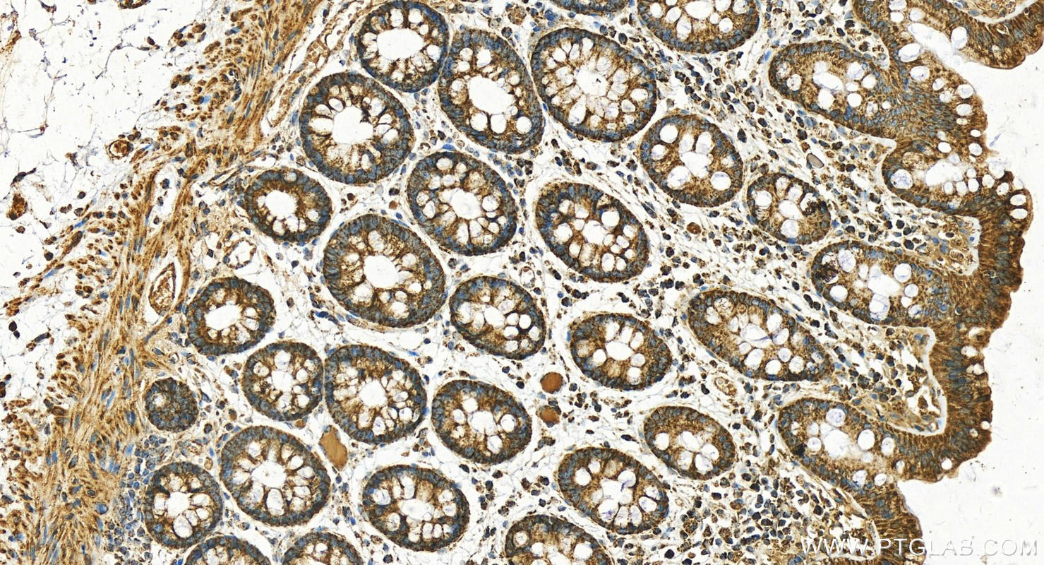 IHC staining of human  colon using 16215-1-AP