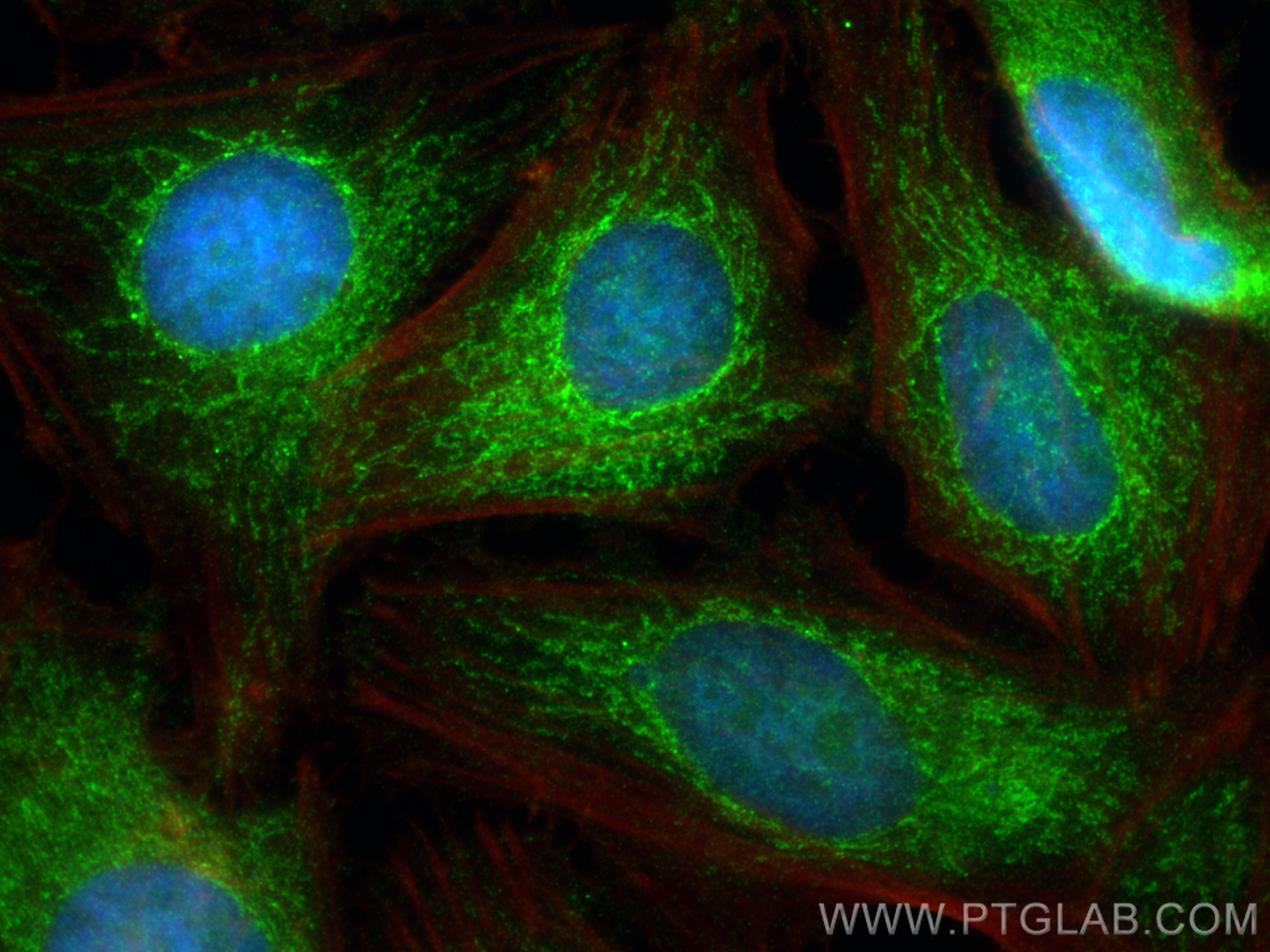 IF Staining of HeLa using 16215-1-AP