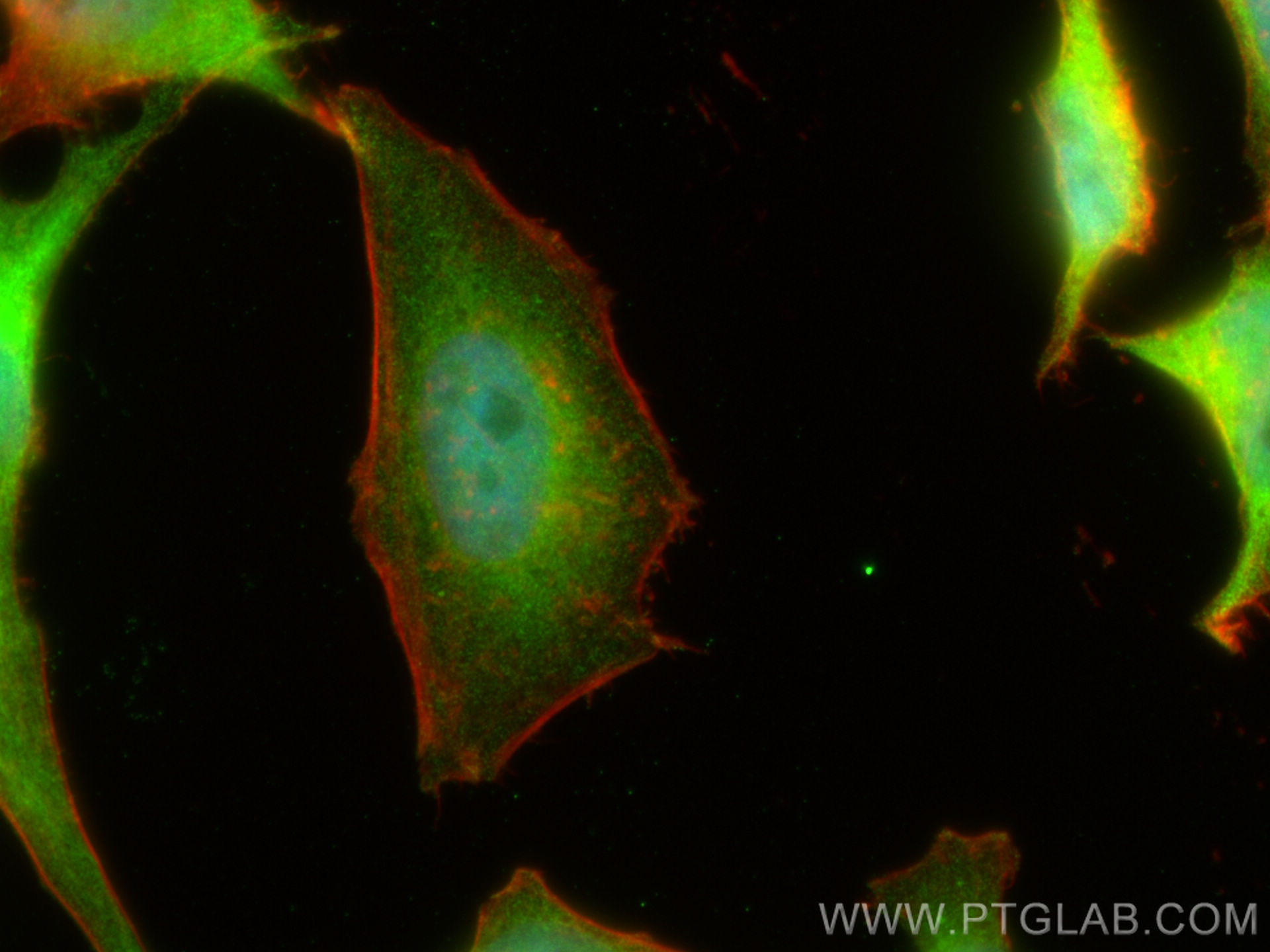 IF Staining of HepG2 using 14755-1-AP