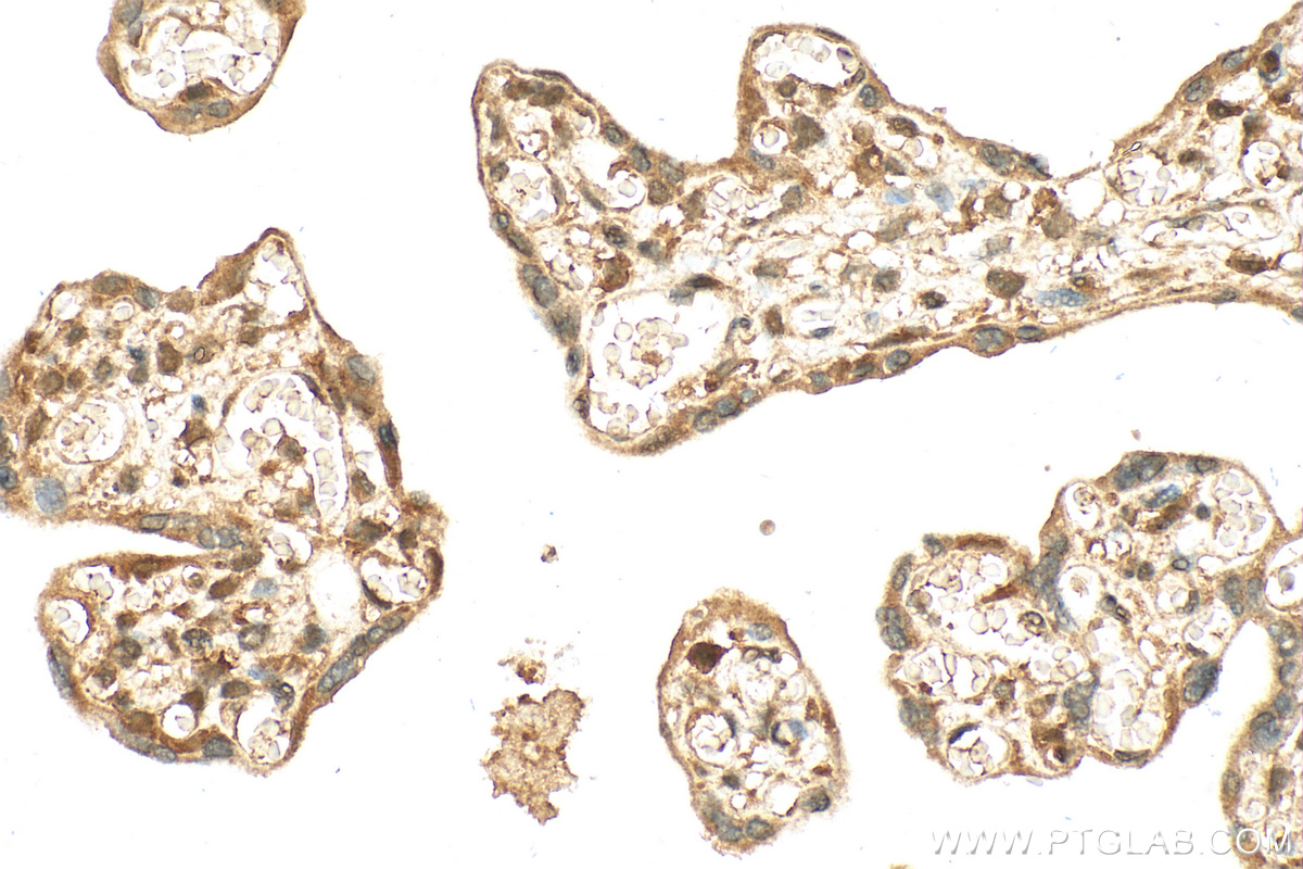 IHC staining of human placenta using 68005-1-Ig (same clone as 68005-1-PBS)