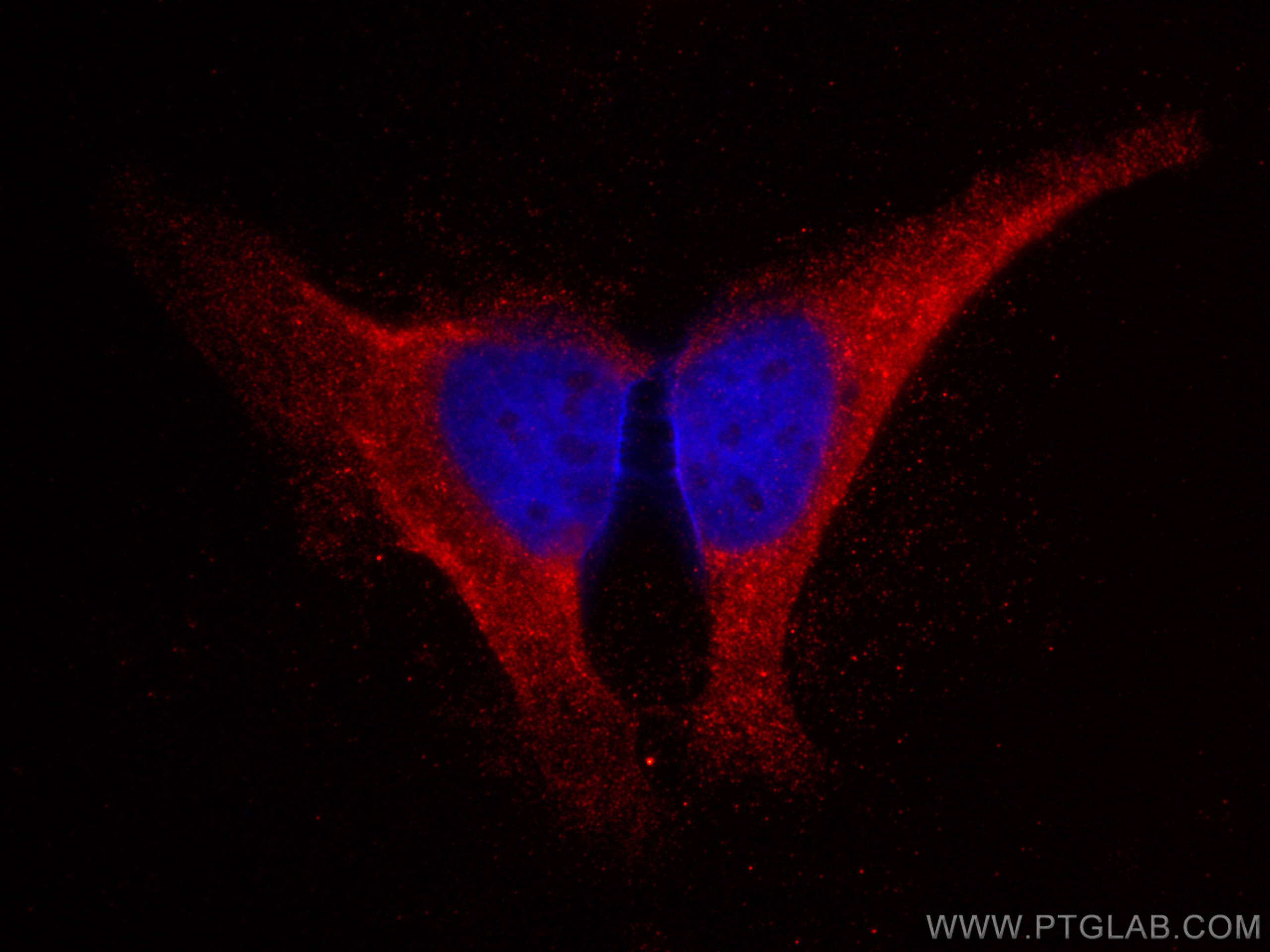 IF Staining of HeLa using CL594-67373