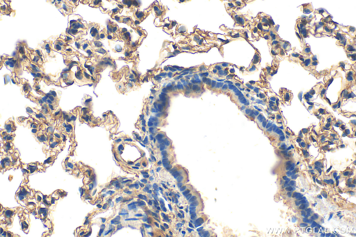 IHC staining of rat lung using 24743-1-AP