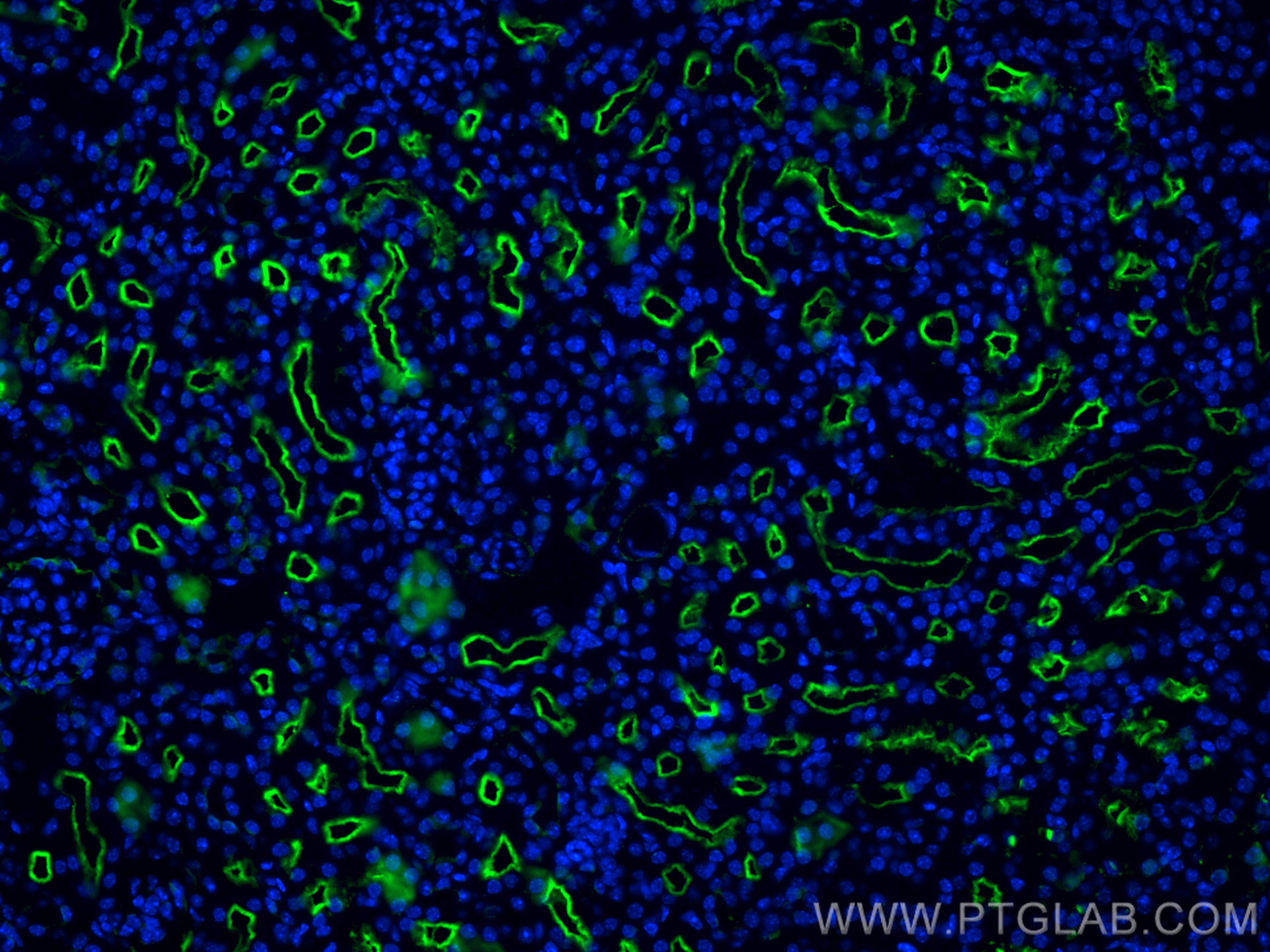 IF Staining of mouse kidney using 28868-1-AP