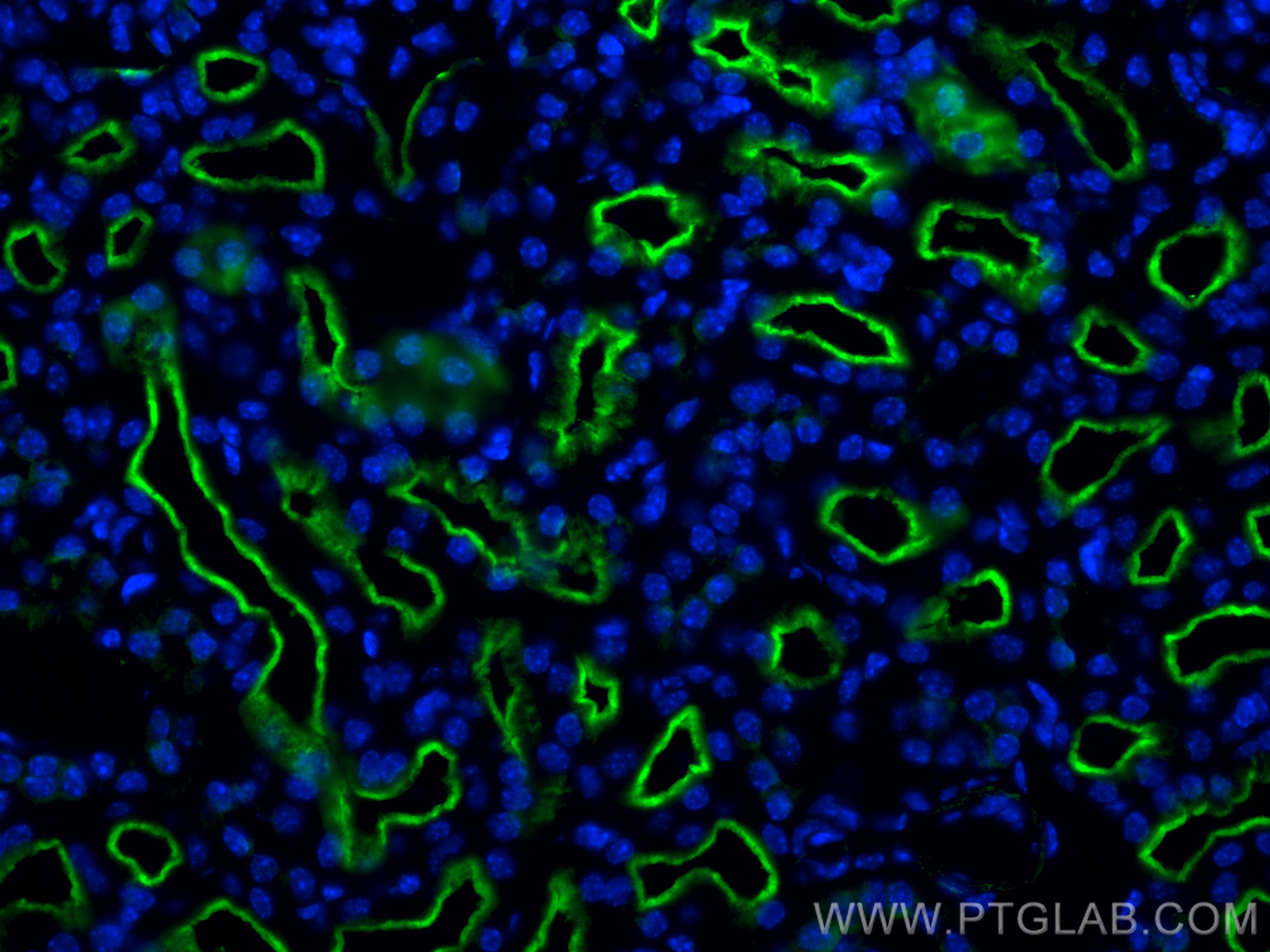 IF Staining of mouse kidney using 28868-1-AP