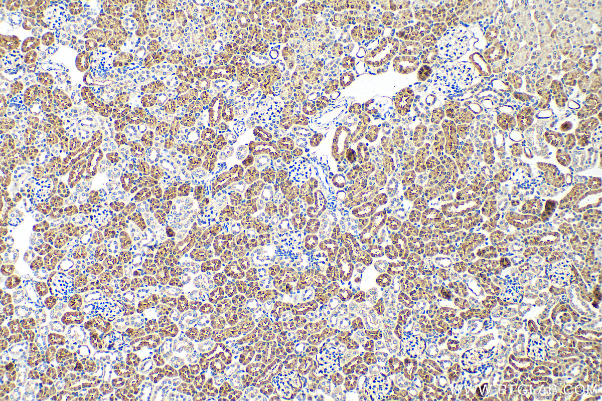 IHC staining of mouse kidney using 26834-1-AP