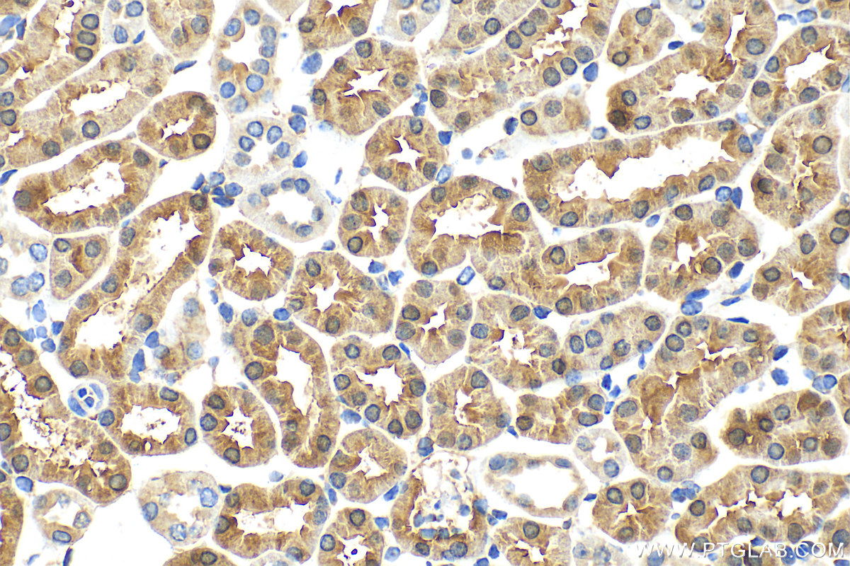 IHC staining of mouse kidney using 26834-1-AP