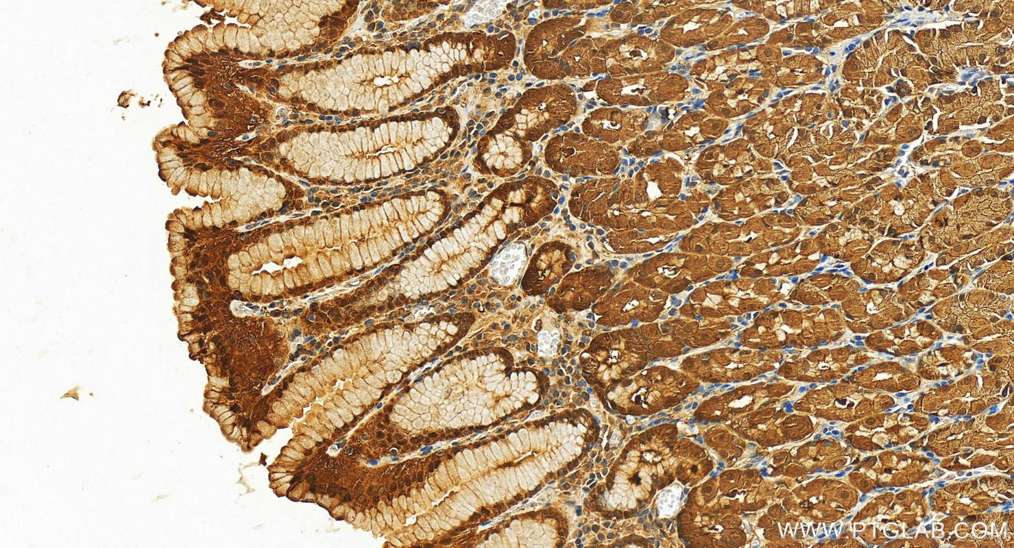 IHC staining of human stomach using 12406-1-AP