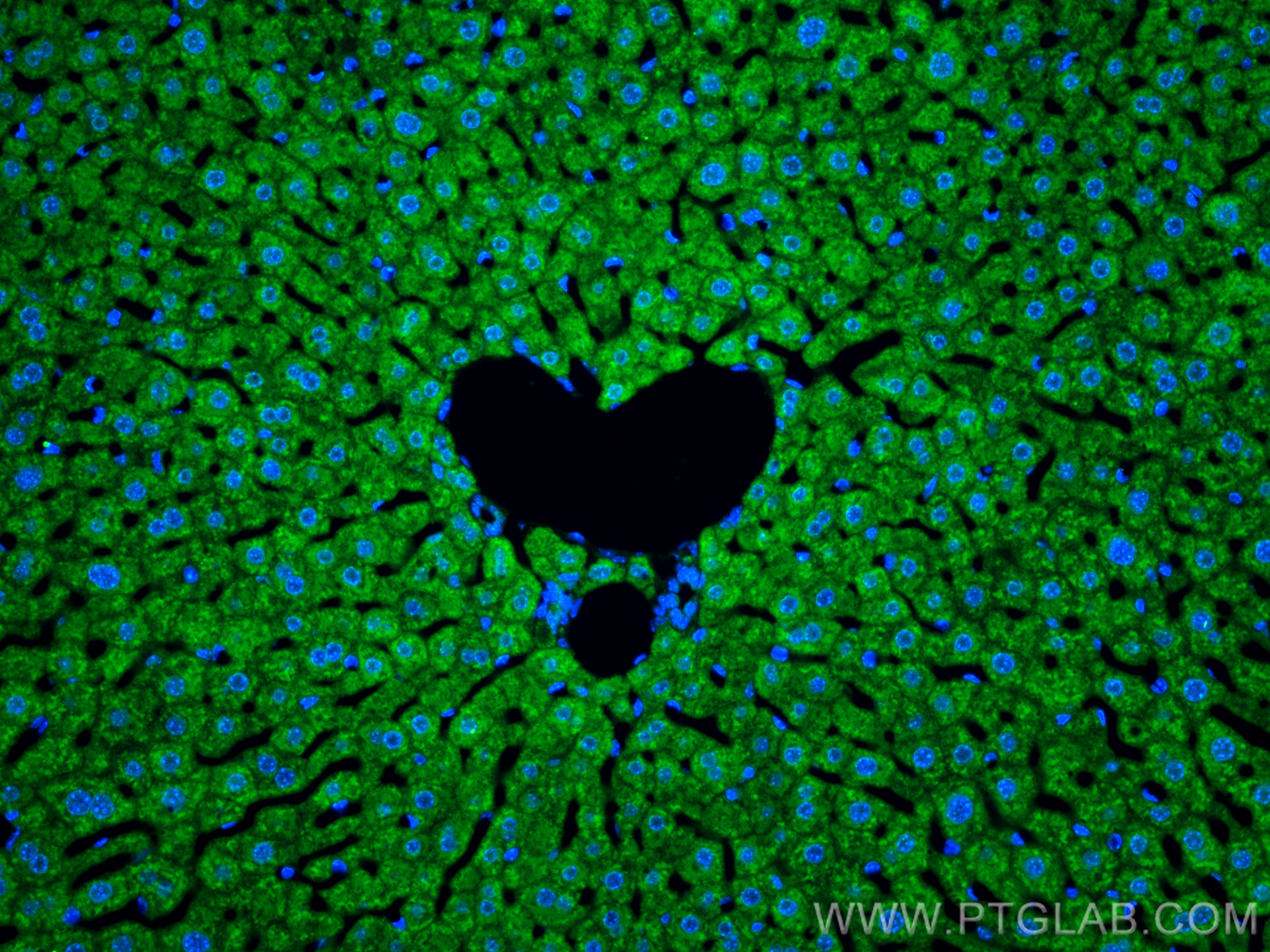 IF Staining of mouse liver using 12406-1-AP