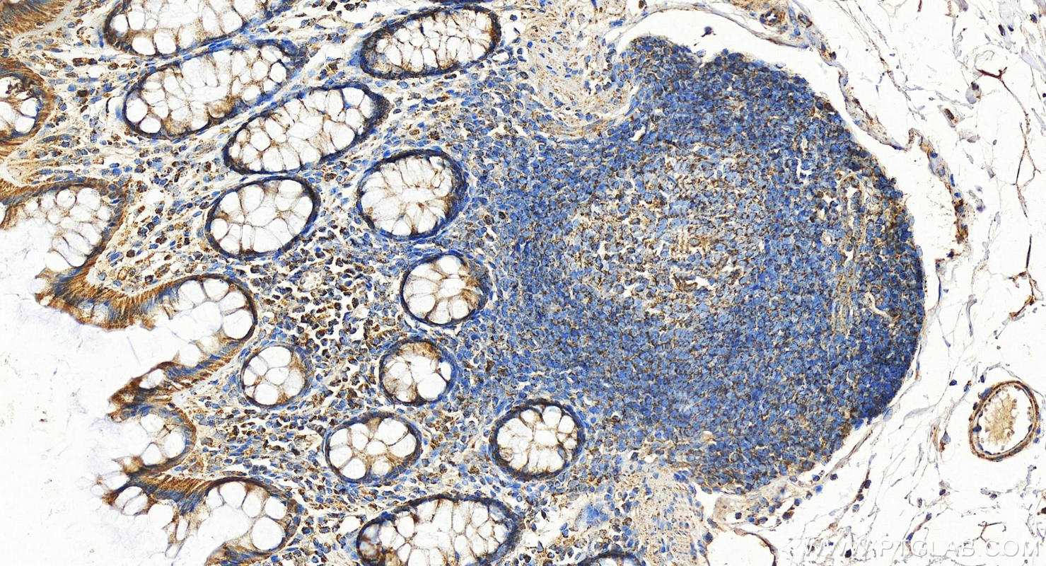 IHC staining of human colon using 11134-1-AP