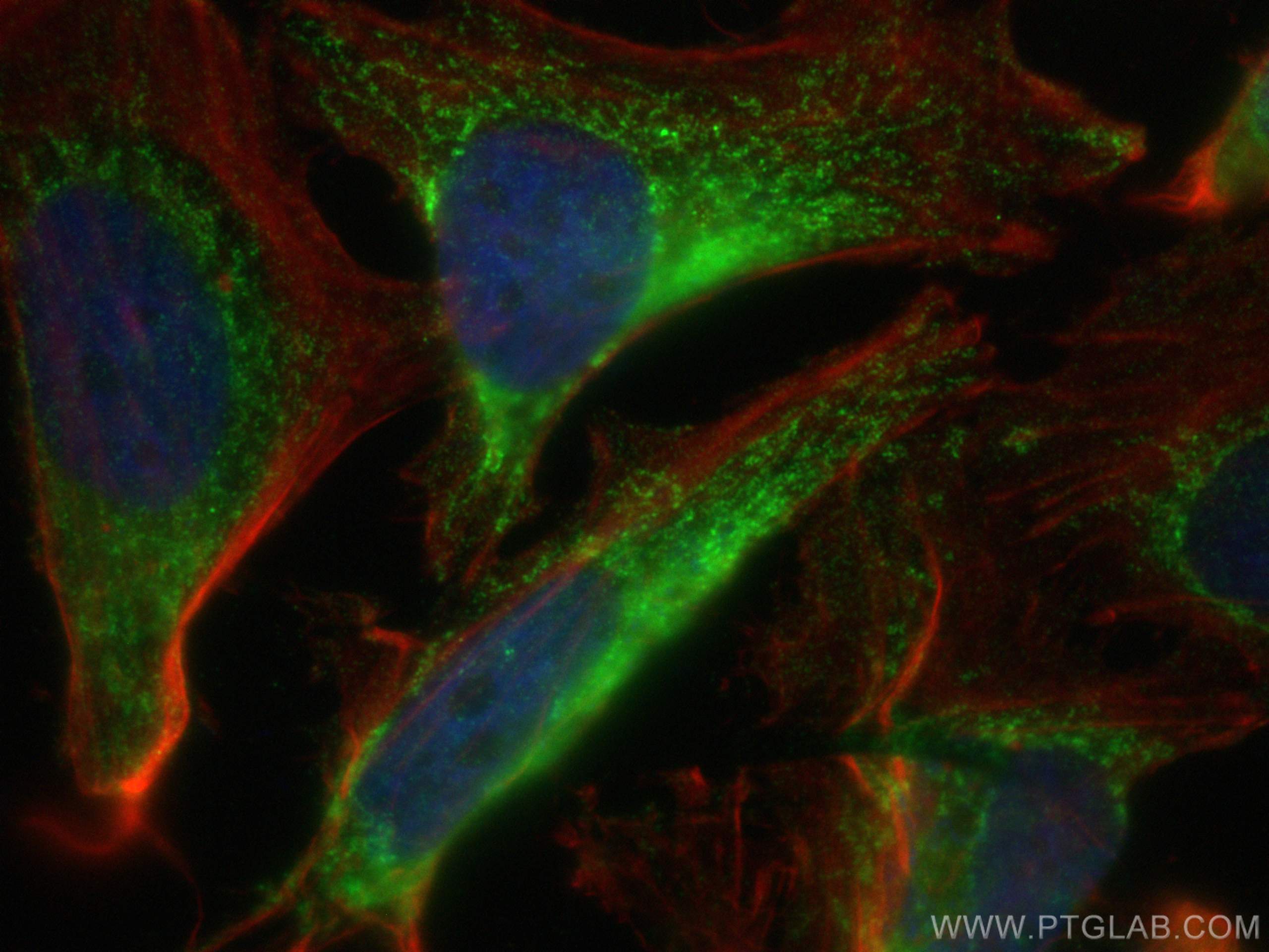 IF Staining of HeLa using 11134-1-AP