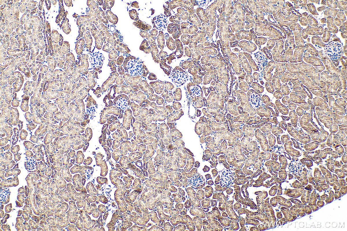 IHC staining of mouse kidney using 11134-1-AP