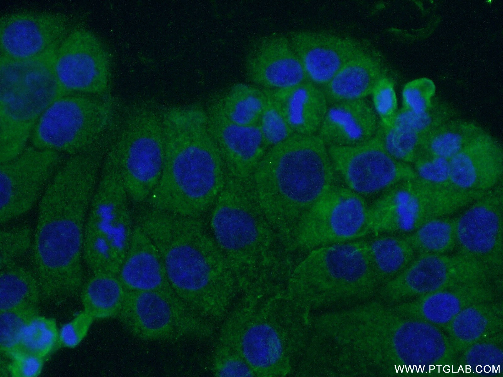 IF Staining of COLO 320 using 17871-1-AP