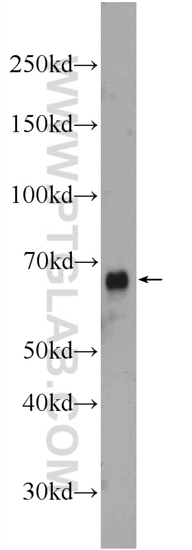 WB analysis of COLO 320 using 17871-1-AP