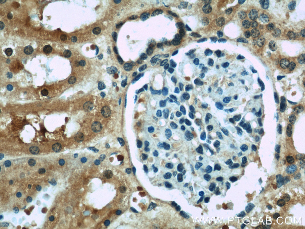 IHC staining of human kidney using 22936-1-AP