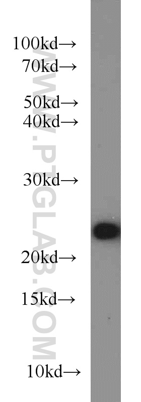 WB analysis of mouse liver using 22936-1-AP