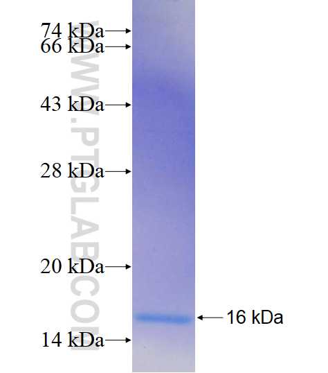 ACOT6 fusion protein Ag18981 SDS-PAGE