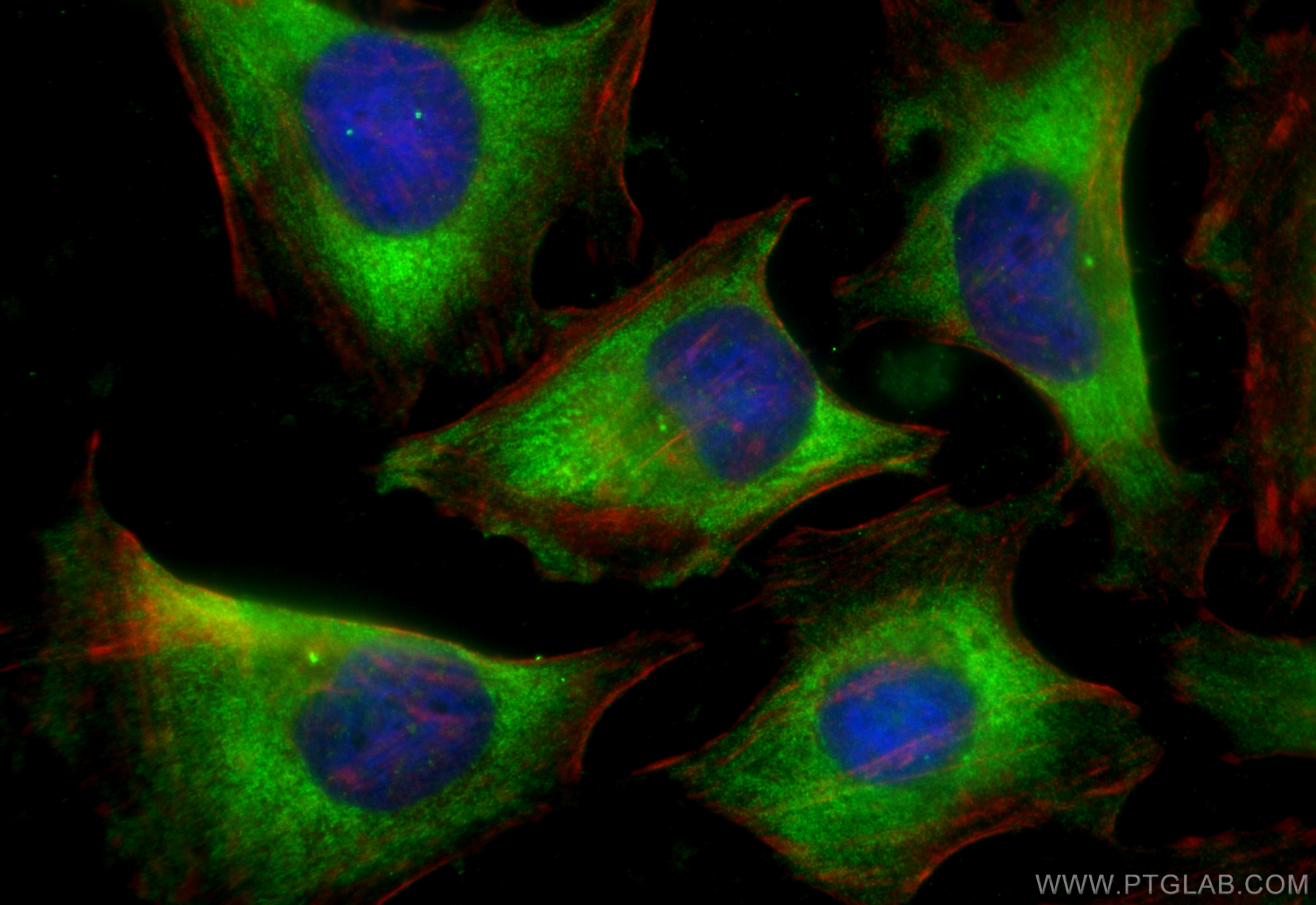 IF Staining of HeLa using CL488-60176