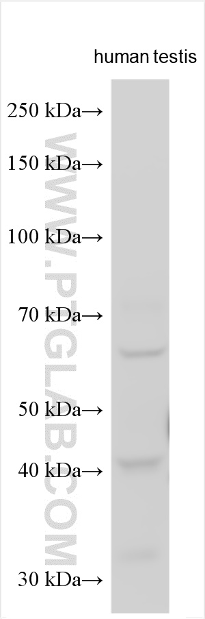 WB analysis using 12487-1-AP