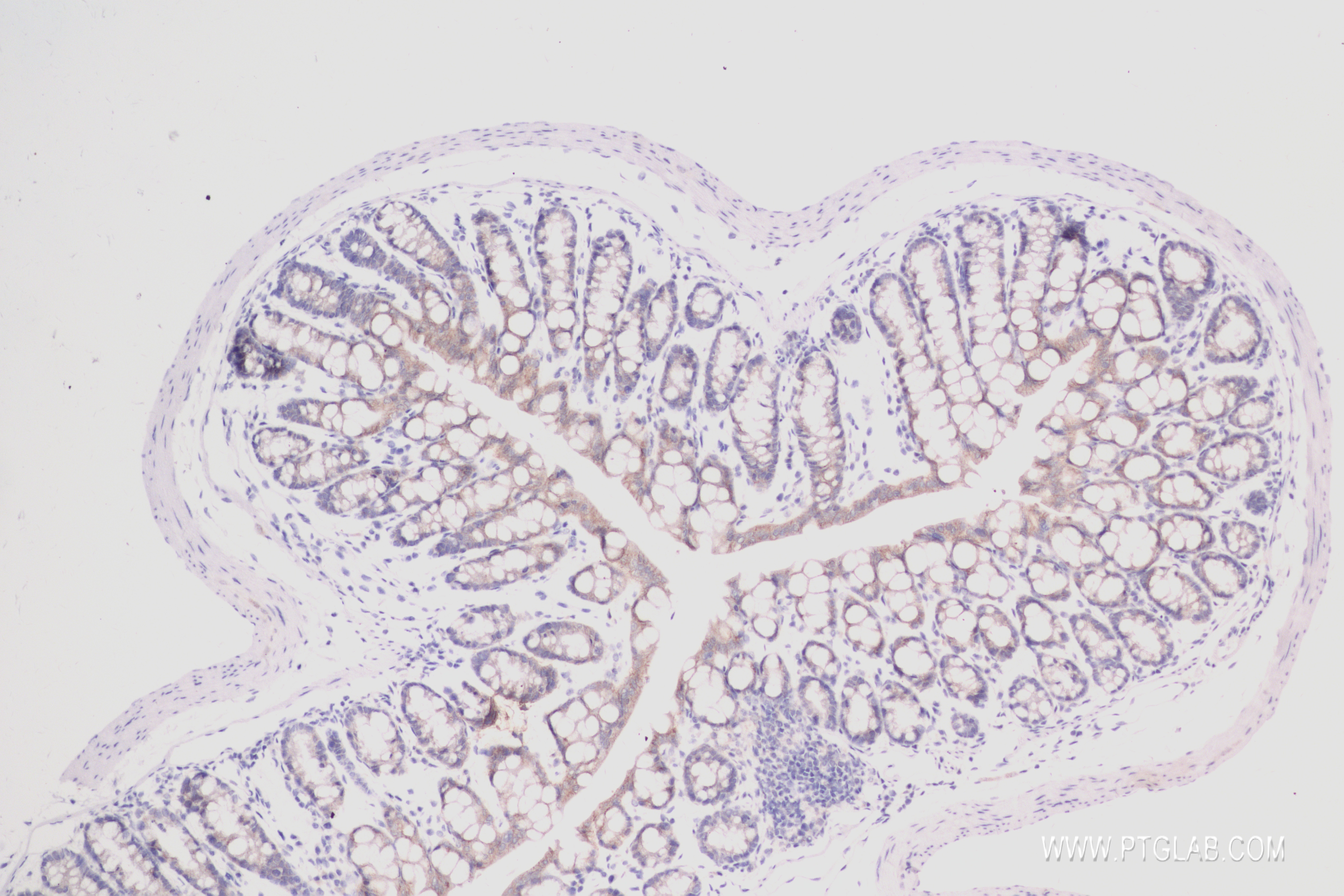 IHC staining of mouse colon using 84033-2-RR