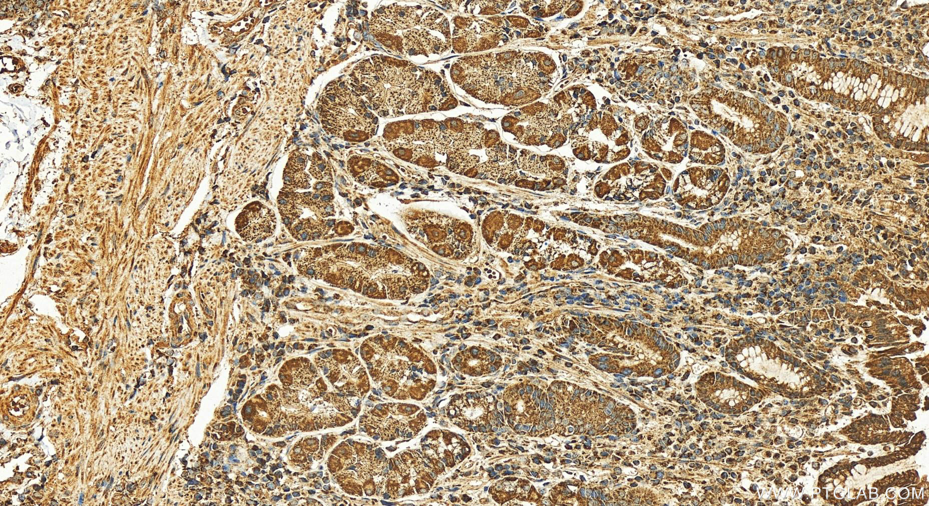 IHC staining of human stomach using 25484-1-AP