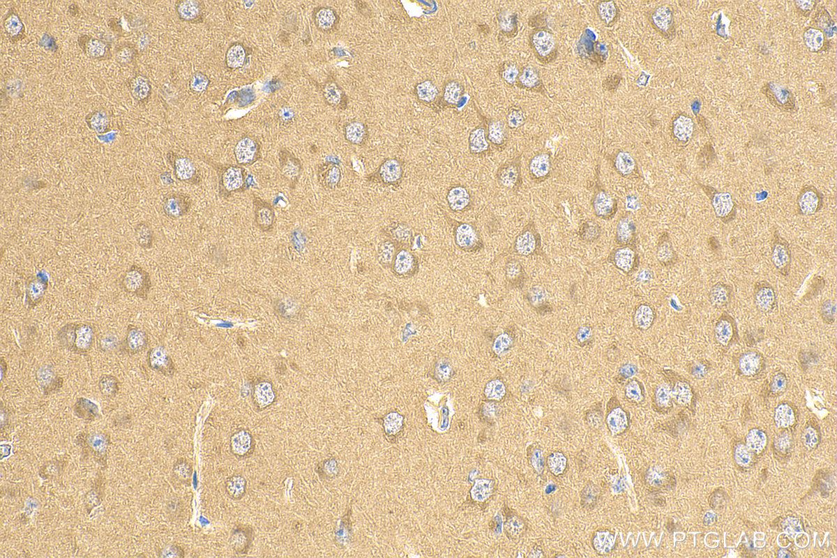 IHC staining of mouse brain using 22401-1-AP