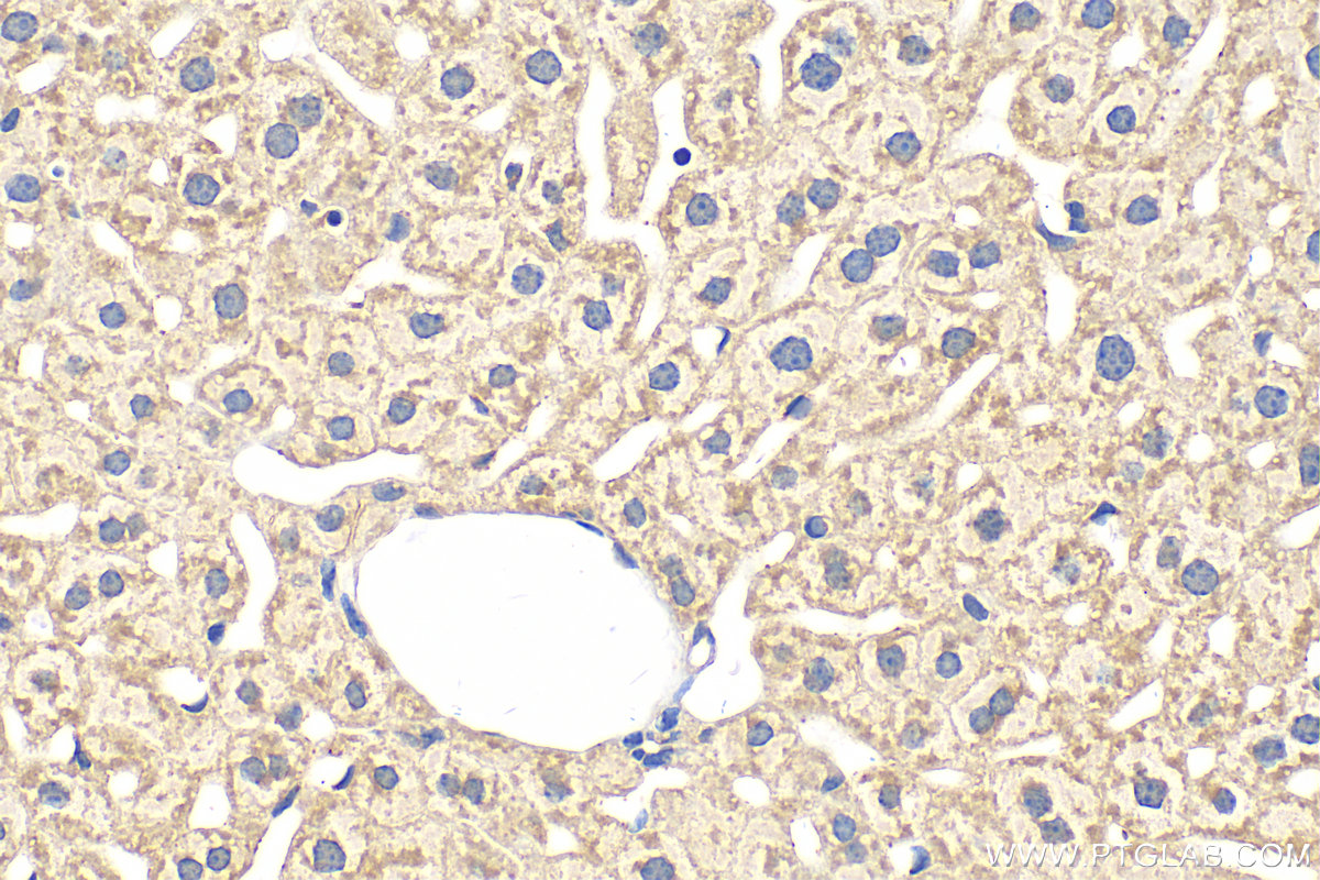 IHC staining of mouse liver using 16591-1-AP