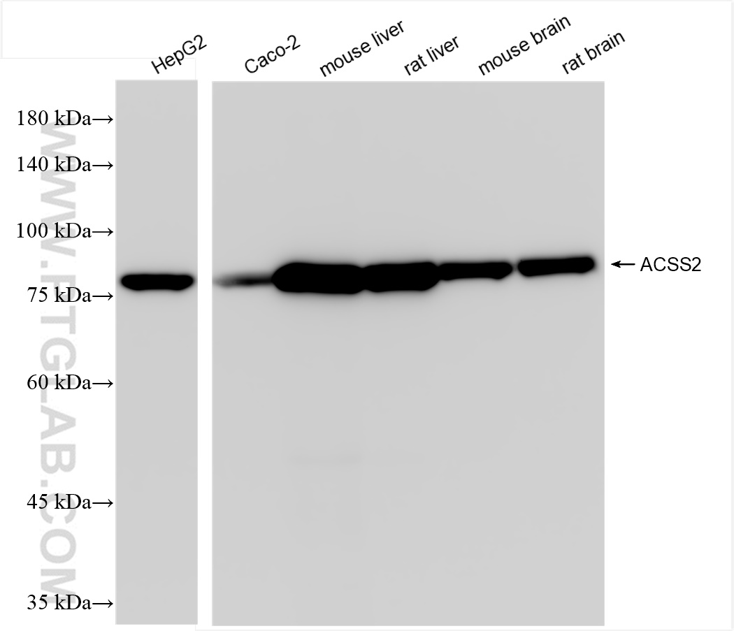 WB analysis using 84774-7-RR (same clone as 84774-7-PBS)