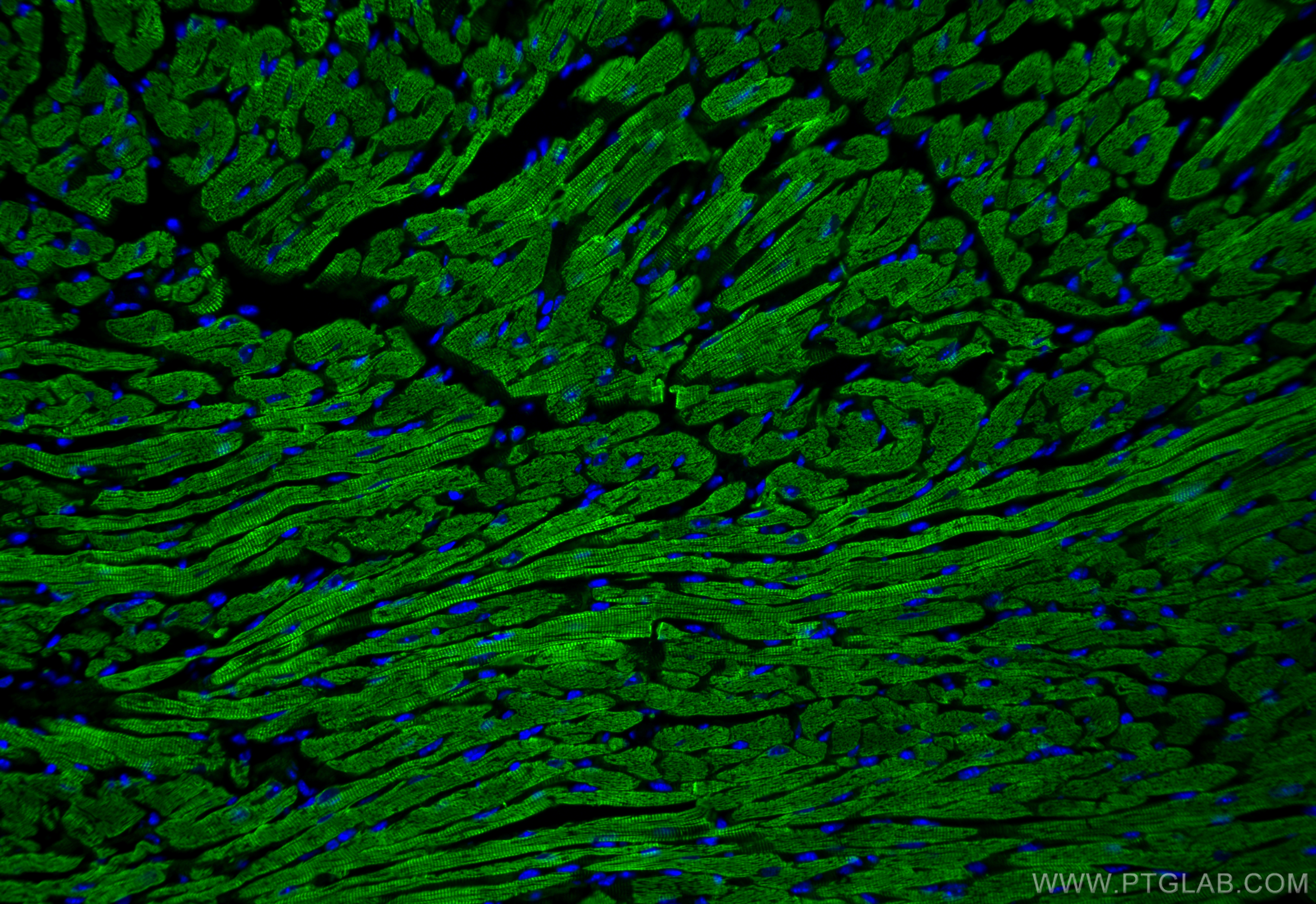 IF Staining of mouse heart using 23660-1-AP