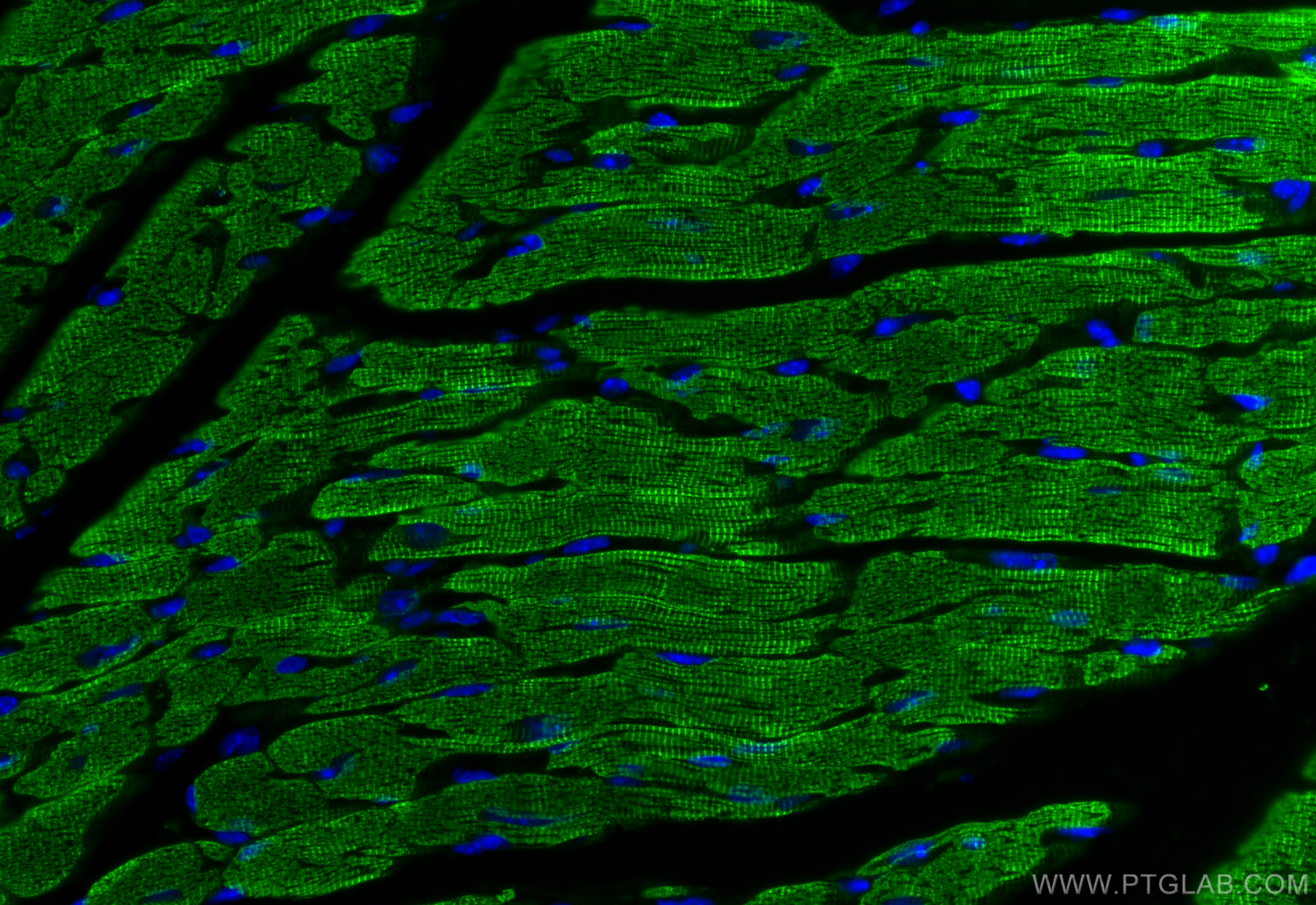 IF Staining of mouse heart using 23660-1-AP