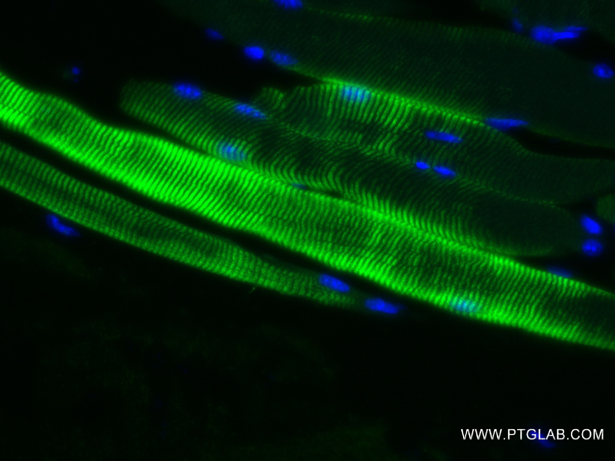 IF Staining of mouse skeletal muscle using 82714-5-RR