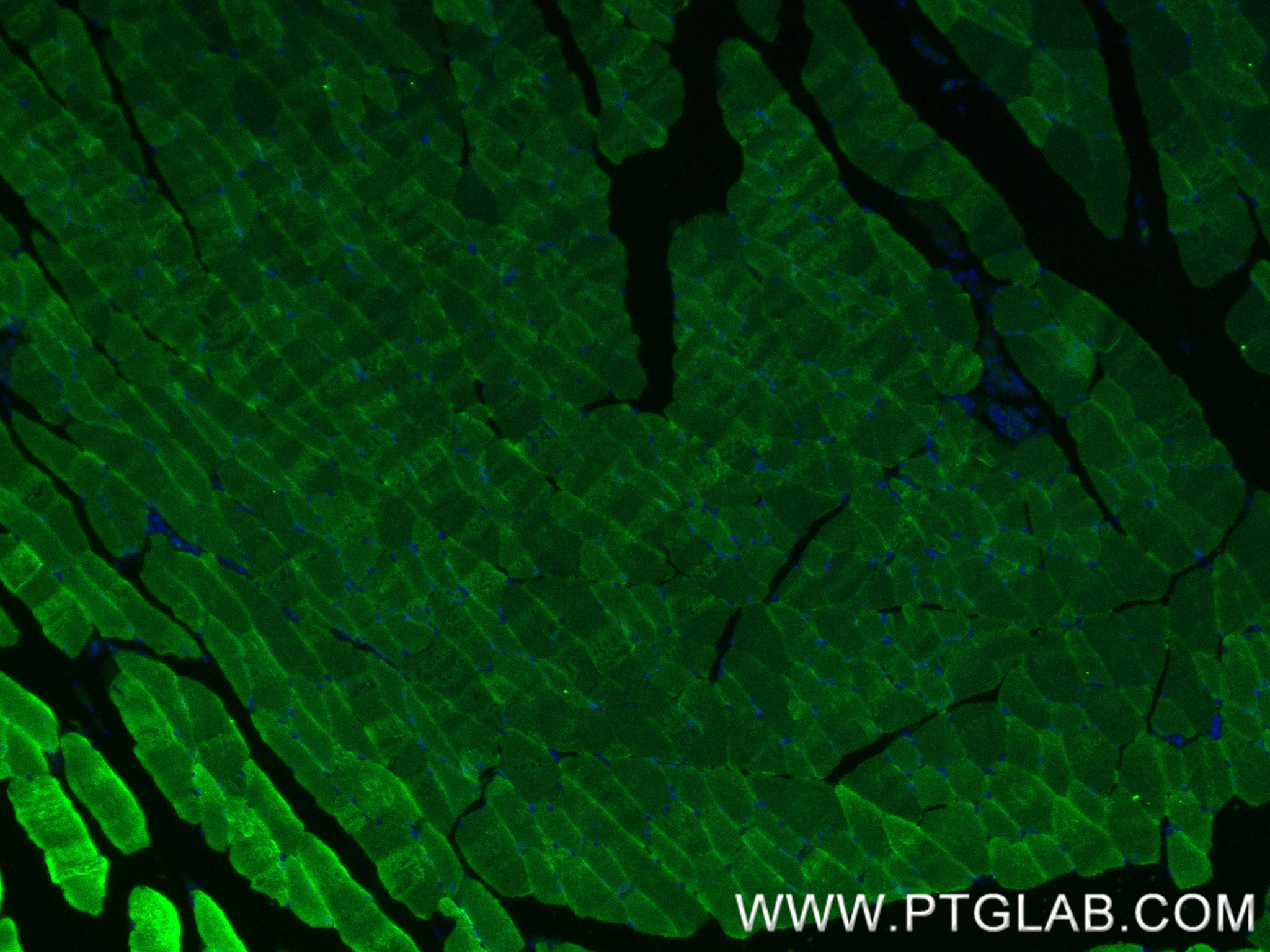 IF Staining of mouse skeletal muscle using 82714-5-RR