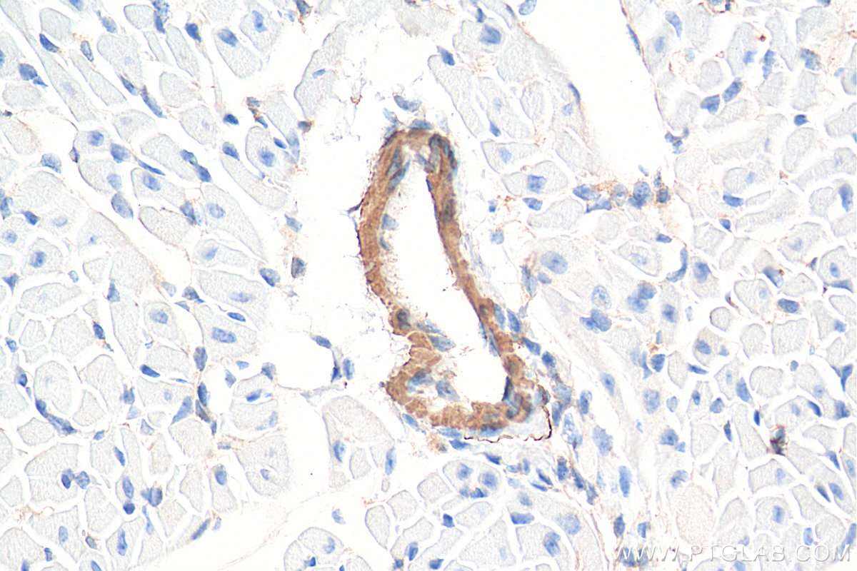 IHC staining of mouse heart using 55135-1-AP