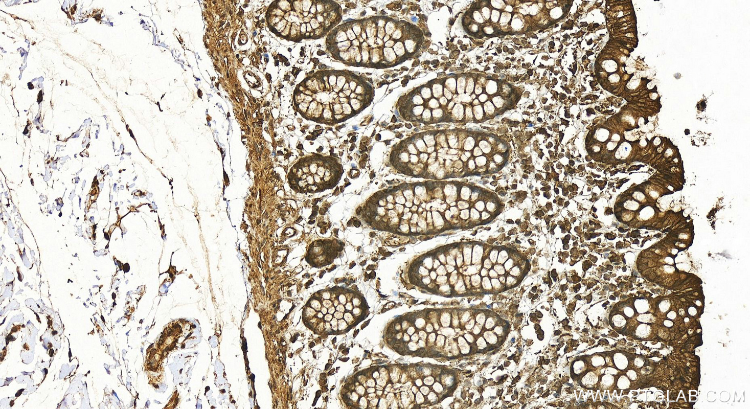 IHC staining of human colon using 20536-1-AP