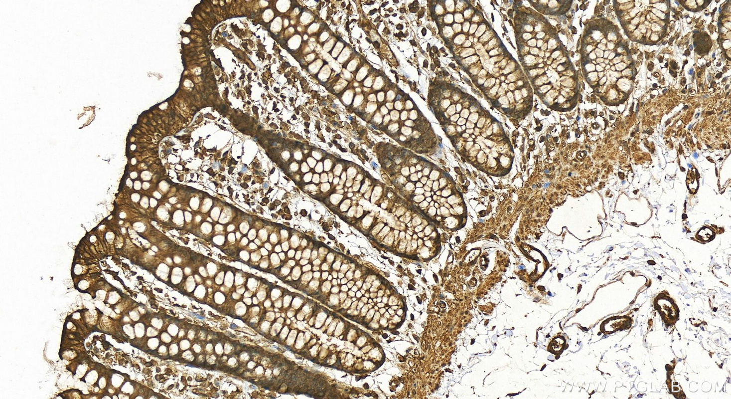 IHC staining of human colon using 20536-1-AP