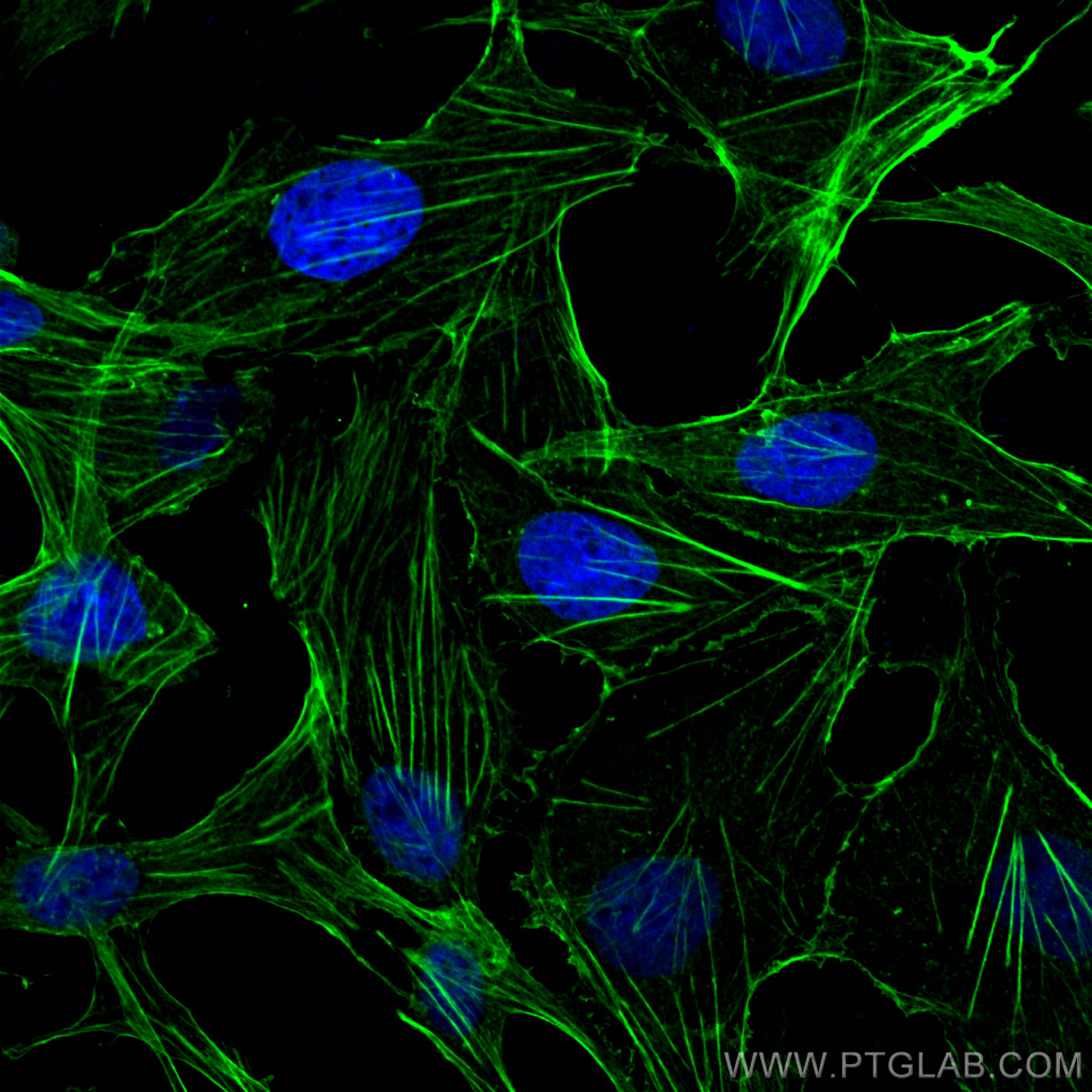 IF Staining of MDCK using 20536-1-AP