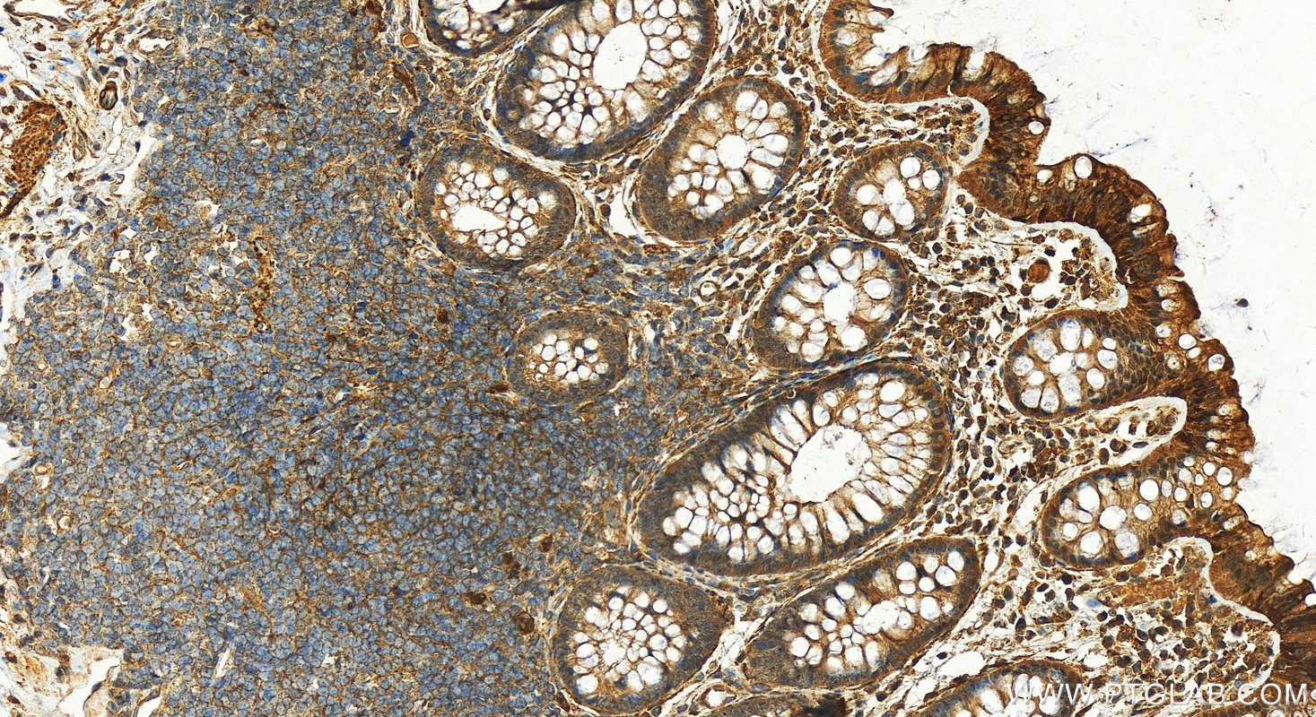 IHC staining of human colon using 23082-1-AP