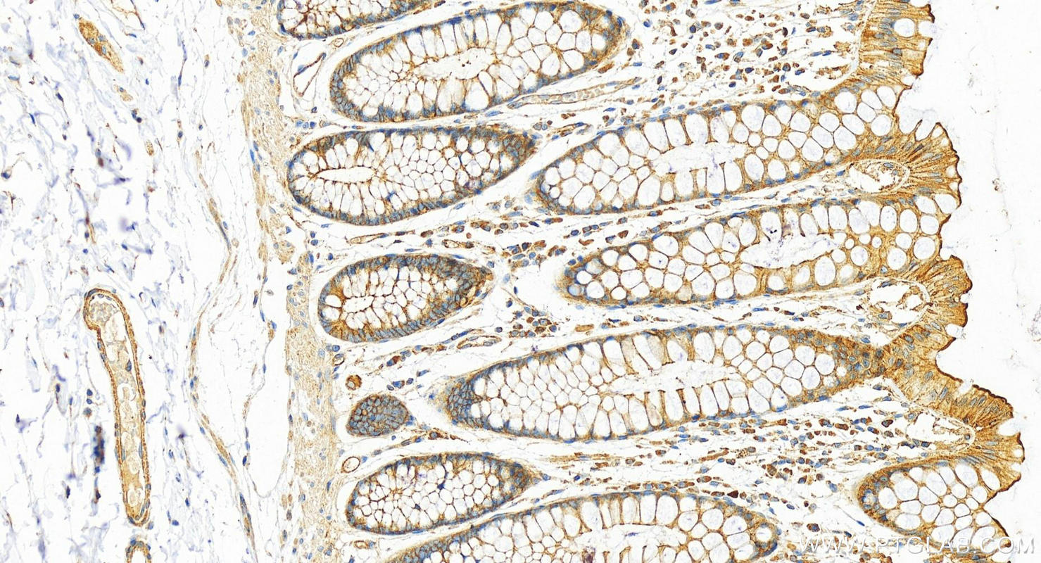 IHC staining of human colon using 11227-1-AP